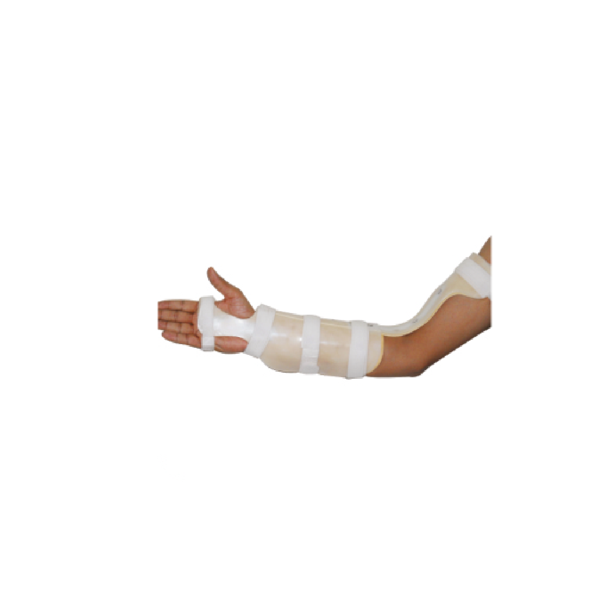 Arm Support Splint