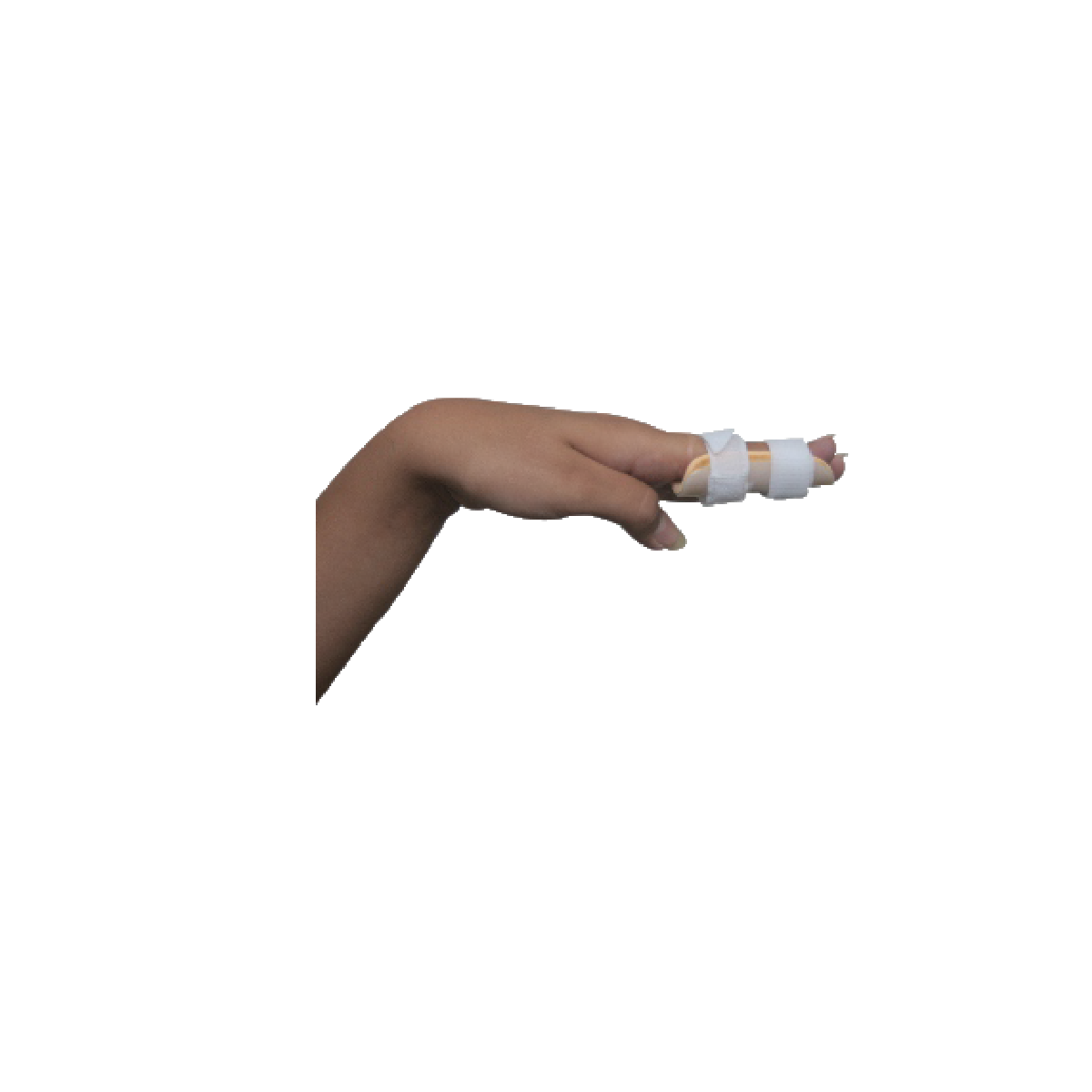 Arm Support Splint